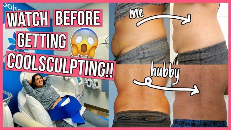 Cool Sculpting Reviews