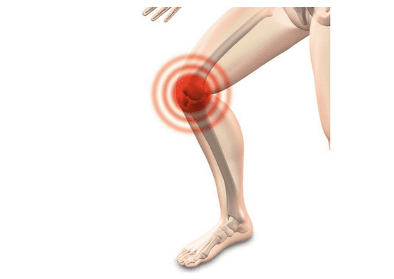 8 Natural Remedies For Knee Pain