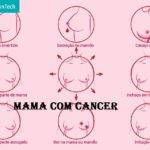 Mama Com Cancer (2022) Everything You Need To Know!