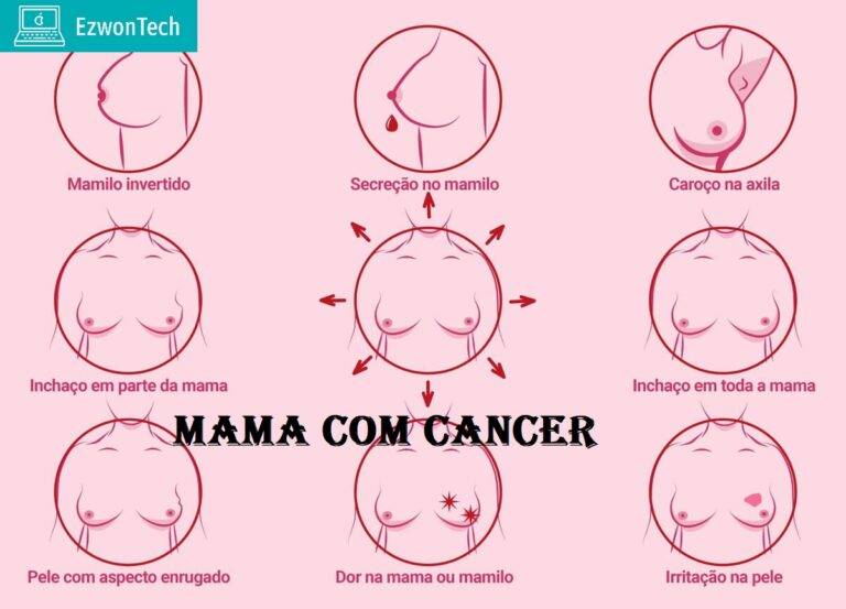 Mama Com Cancer