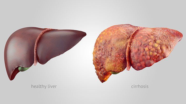 Is Your Liver in Danger